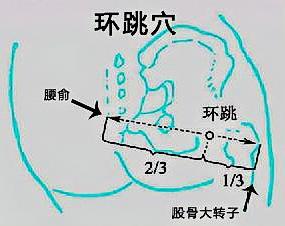 十二保健穴 — 坐骨刺环跳 