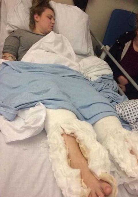 英国女子摔断脚苦等救护车3小时无果,医院:自己过来