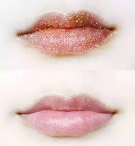 嘴唇干裂脱皮怎么办?这些小方法帮助你!