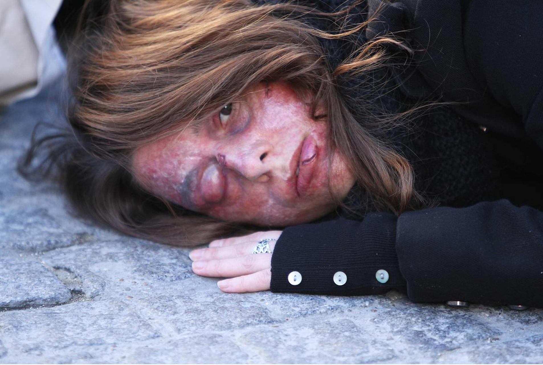 湖北十堰一女子被家暴后选择报警,其丈夫当着警察面打妻子!