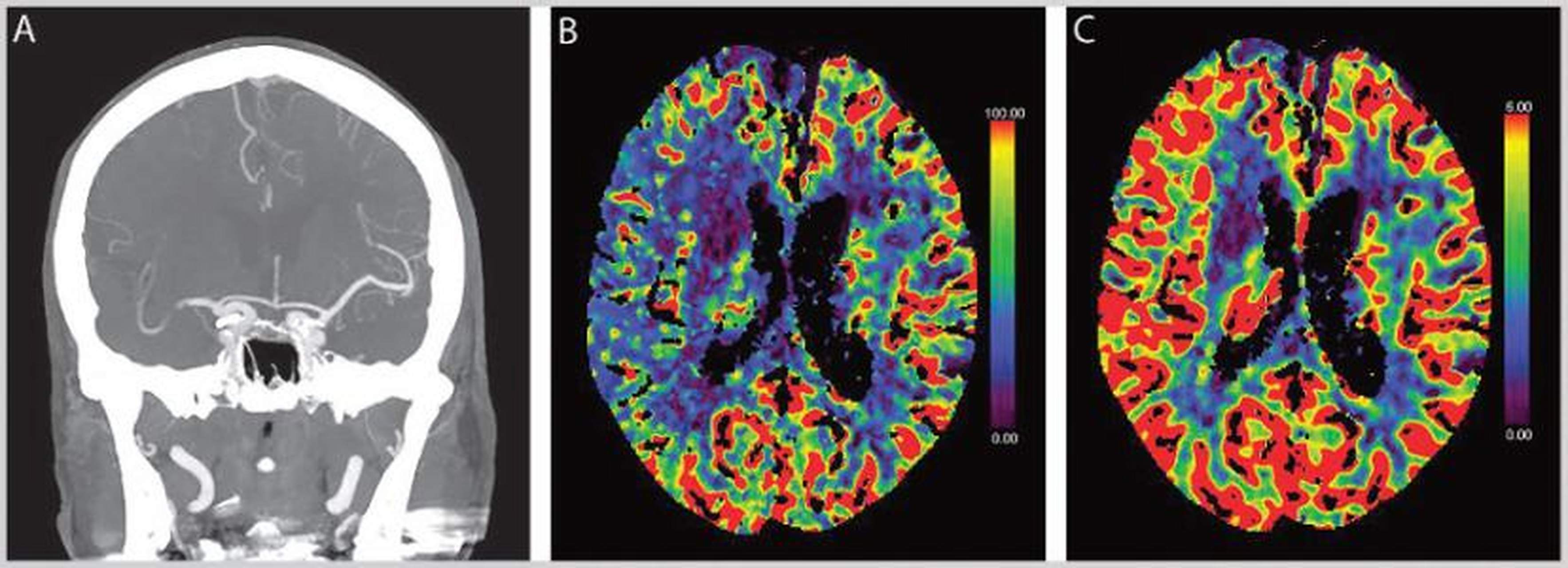 科普知识竞赛#脑血流图检查通过脑血流对脑进行进行检查.