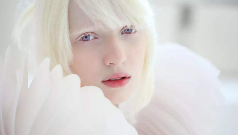 这个18岁的女孩子被称为"仙女",眼睛是紫瞳,头发和皮肤很雪白