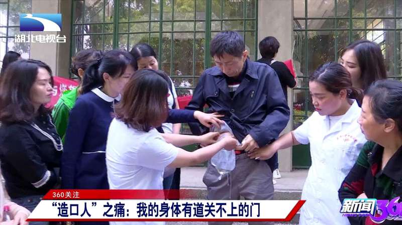 “造口人”之痛：我的身体有道关不上的门,社会,民生,好看视频
