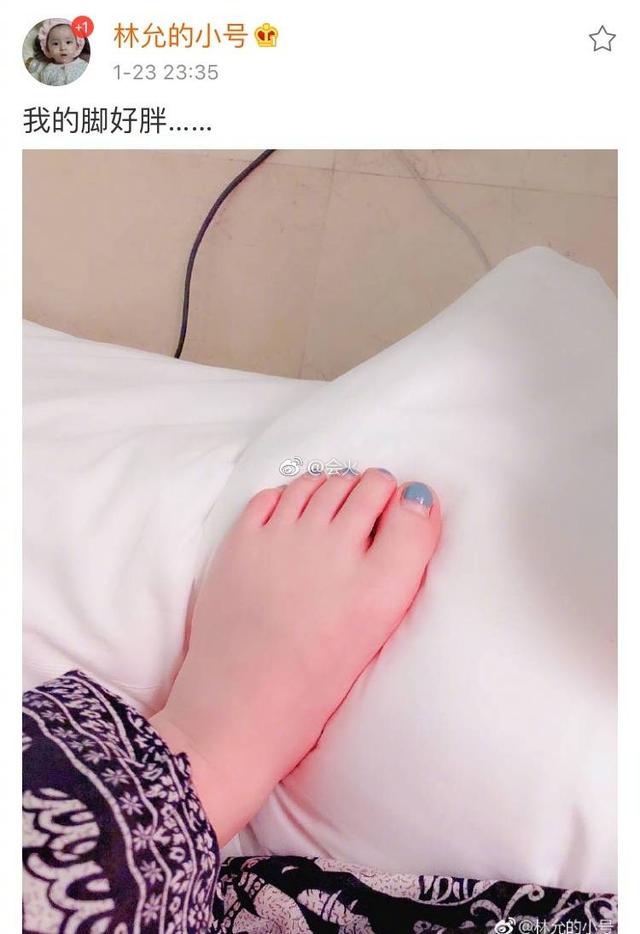 林允深夜晒脚丫照,自嘲又黑又胖,网友附上图片评论称:像猪脚!