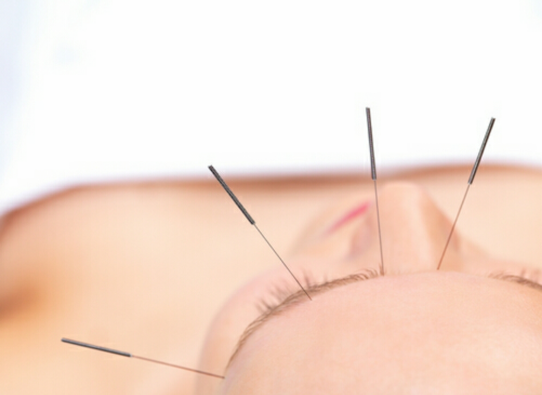 什么是缪刺法?二者有何区别?