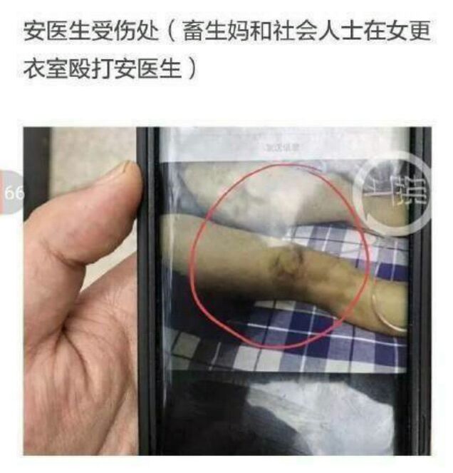 德阳安医生自杀,网络舆论也有份!