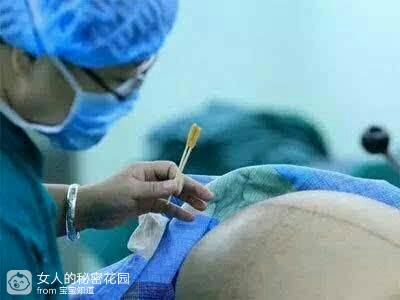 给大家看看剖腹产的麻醉针,女人为了生孩子要忍受的痛苦