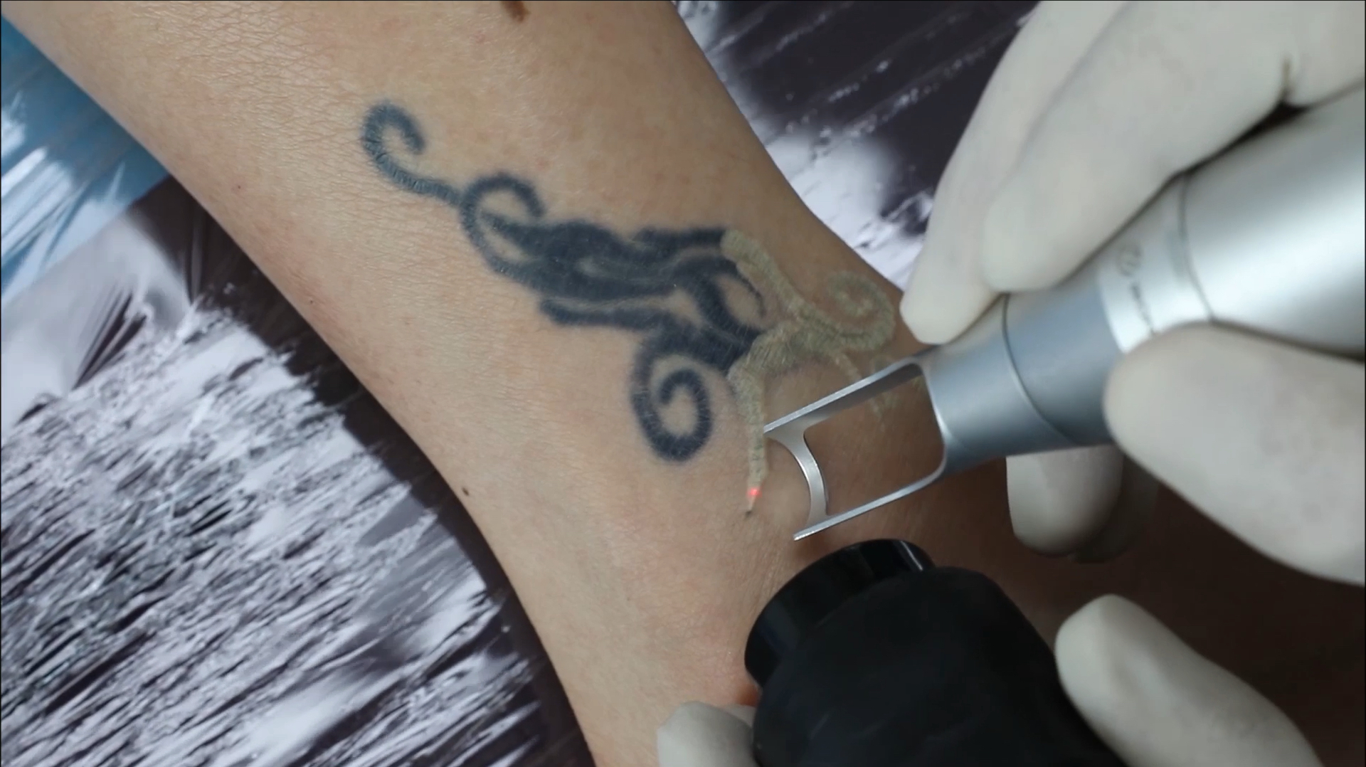 洗完纹身后的注意事项和护理是怎样的?