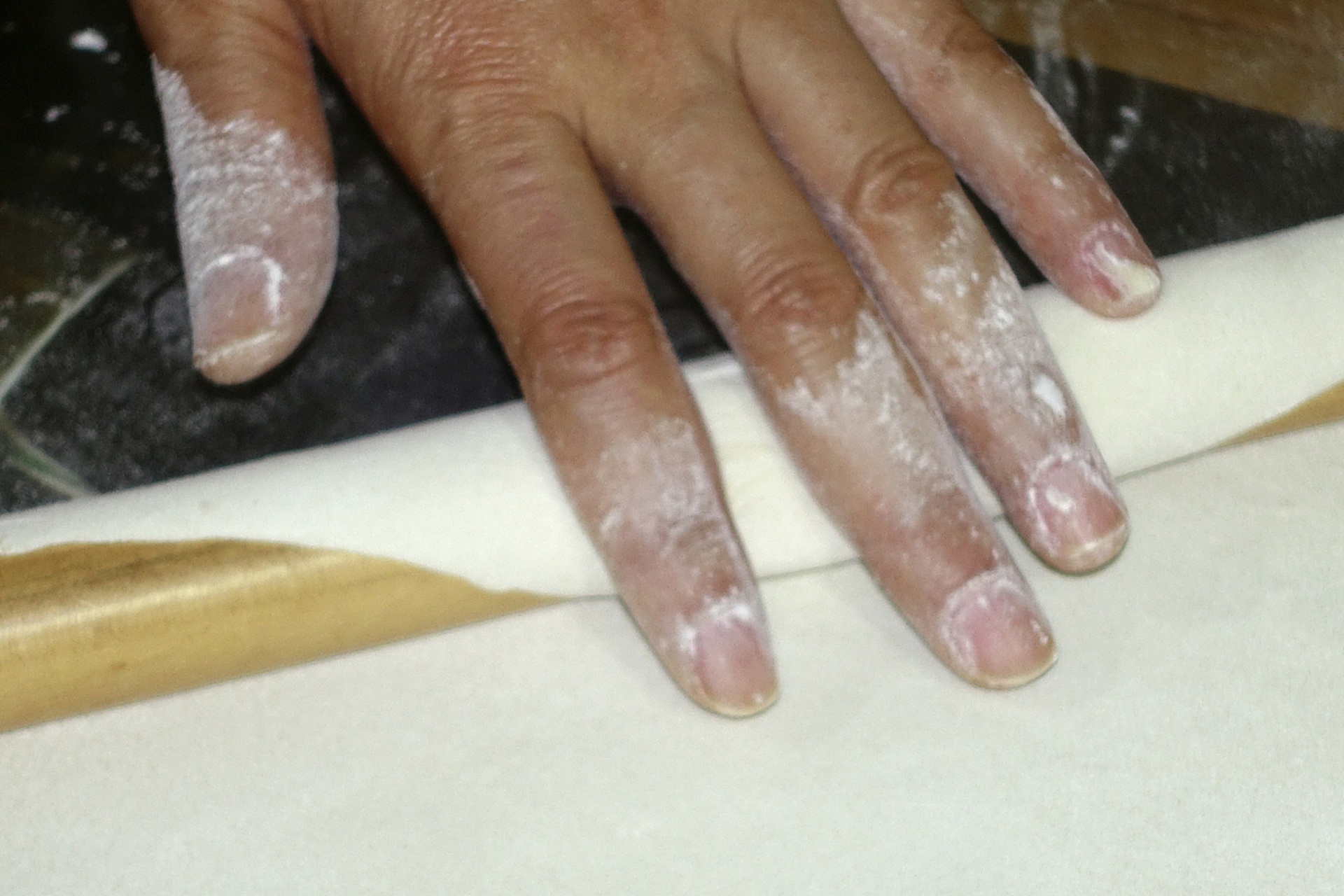 鹅掌风,是民间中医对于手癣的一种叫法,是由于真菌引发的皮肤类疾病