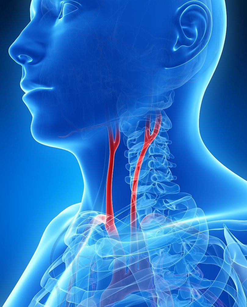 颈动脉体表位置图片