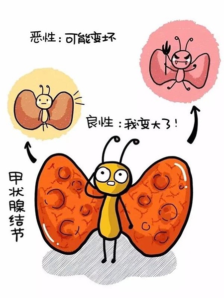 甲状腺结节卡通图片