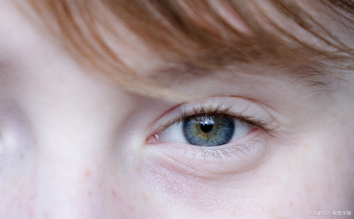 :最近照镜子的时候,突然发现自己的眼球看起来有些不对劲