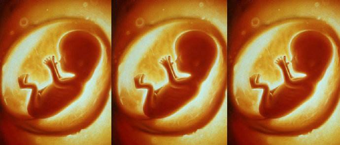 孕38周胎动突然停止,是胎儿发育不好吗?这些情况要注意