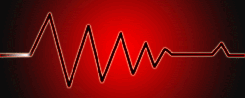 你知道猝死的征兆有哪些吗?