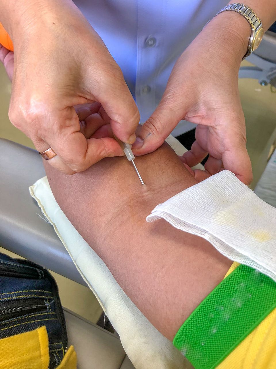 身体埋线,是通过将不同材质的线体埋入人体指定穴位,以达到调节身体