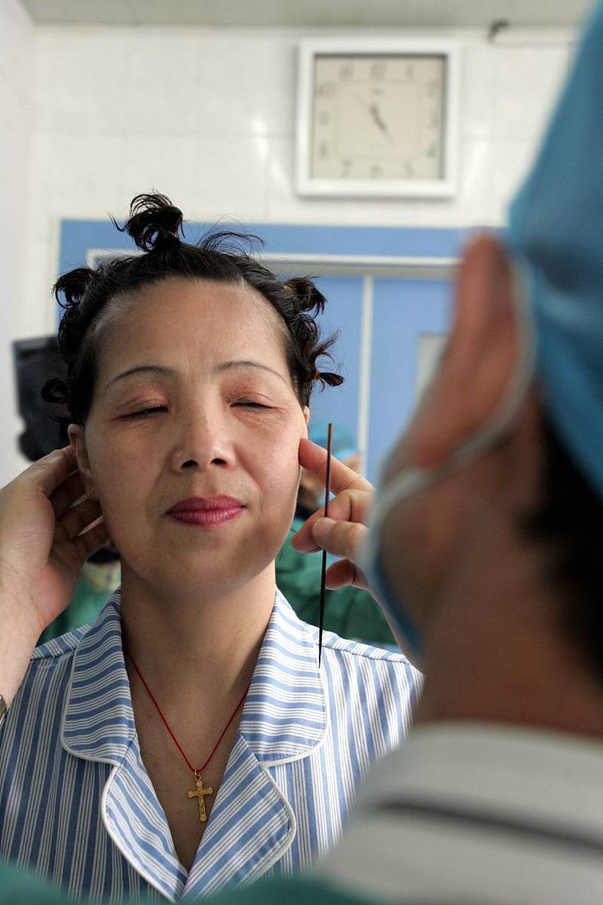 小拉皮手术可以维持多久?