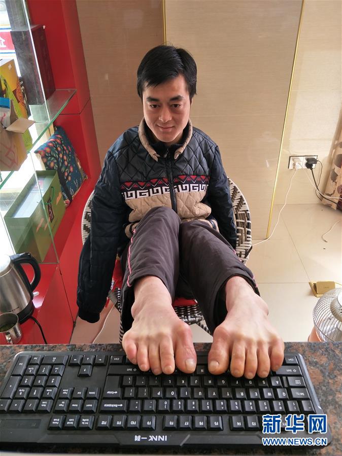 敢问路在何方,路在脚下,湖北小伙陈兹方的"无臂"人生