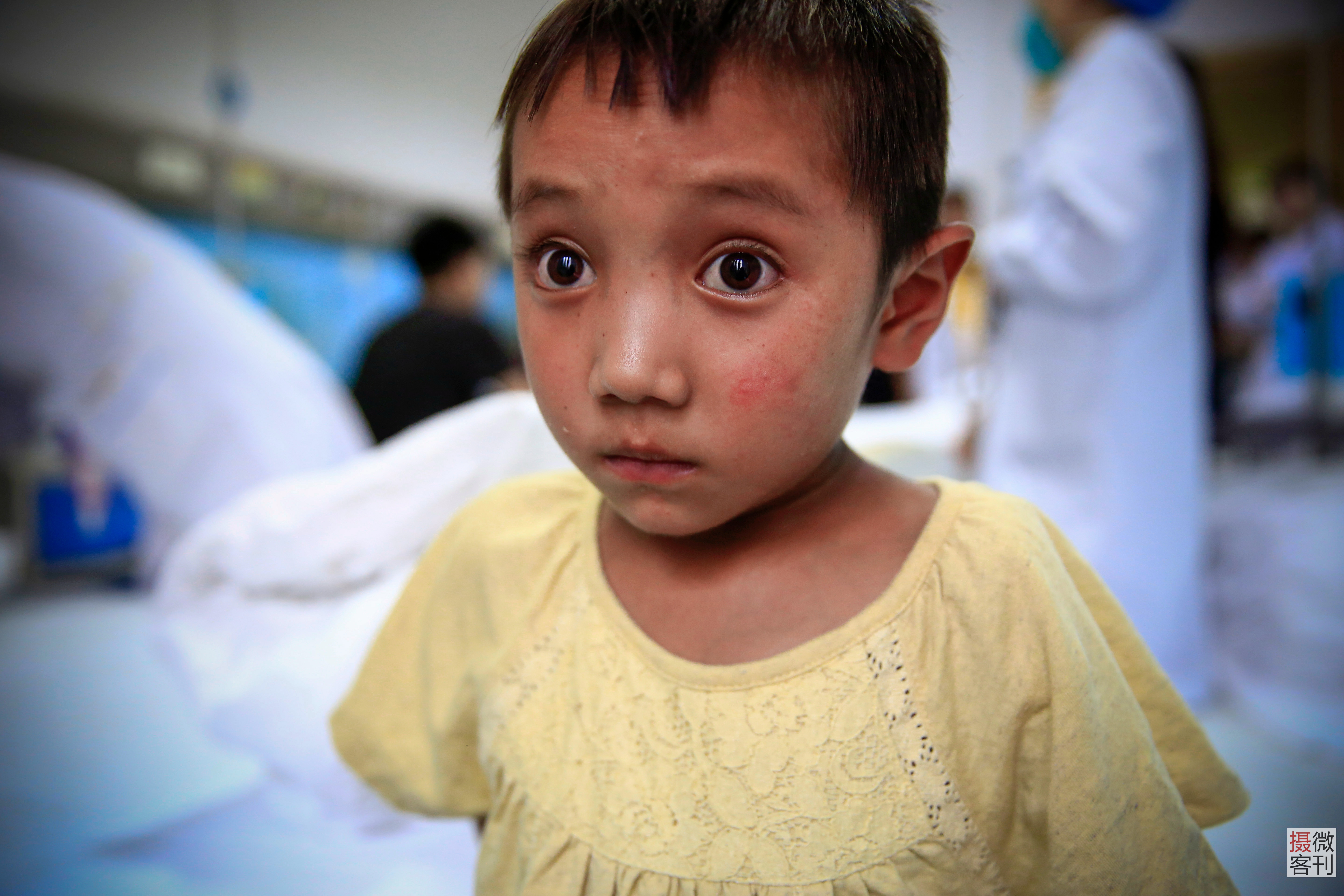 孤女美丽大眼睛即将失明2000公里求医 悲惨遭遇令众人落泪