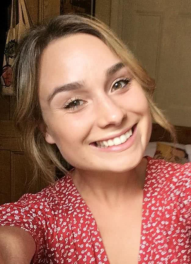 女子一天嚼15000片口香糖,成功瘦到30公斤,嚼肌很发达!