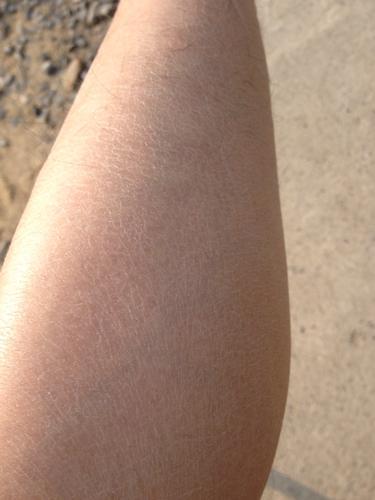 冬天身上干燥有皮屑,脱秋裤时皮屑满天飞,3个小妙招轻松赶走它