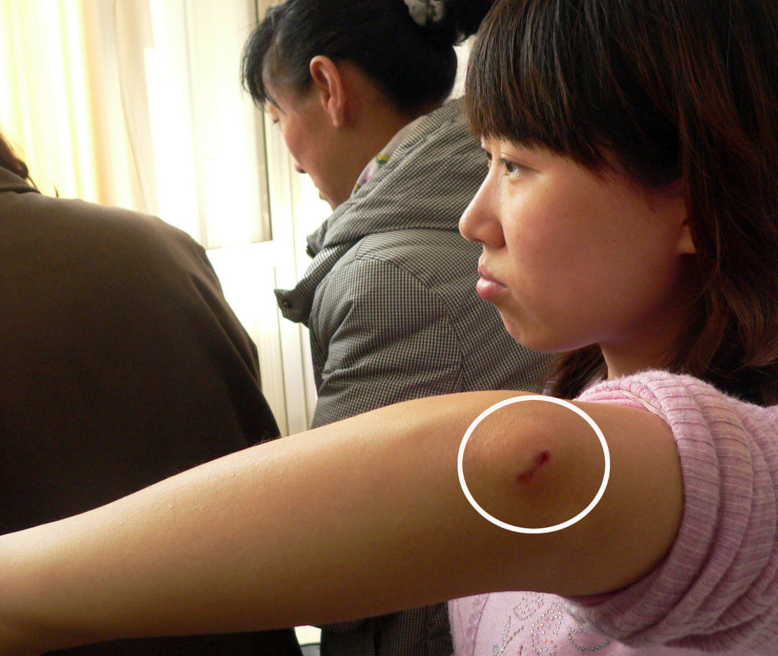 或咬伤后,首先要用肥皂水或其他弱碱性清洗剂和流动清水交替清洗伤口