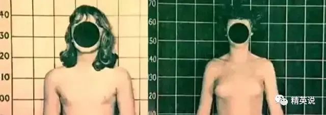 美国史上最残忍人体改造实验:双胞胎婴儿被迫变性