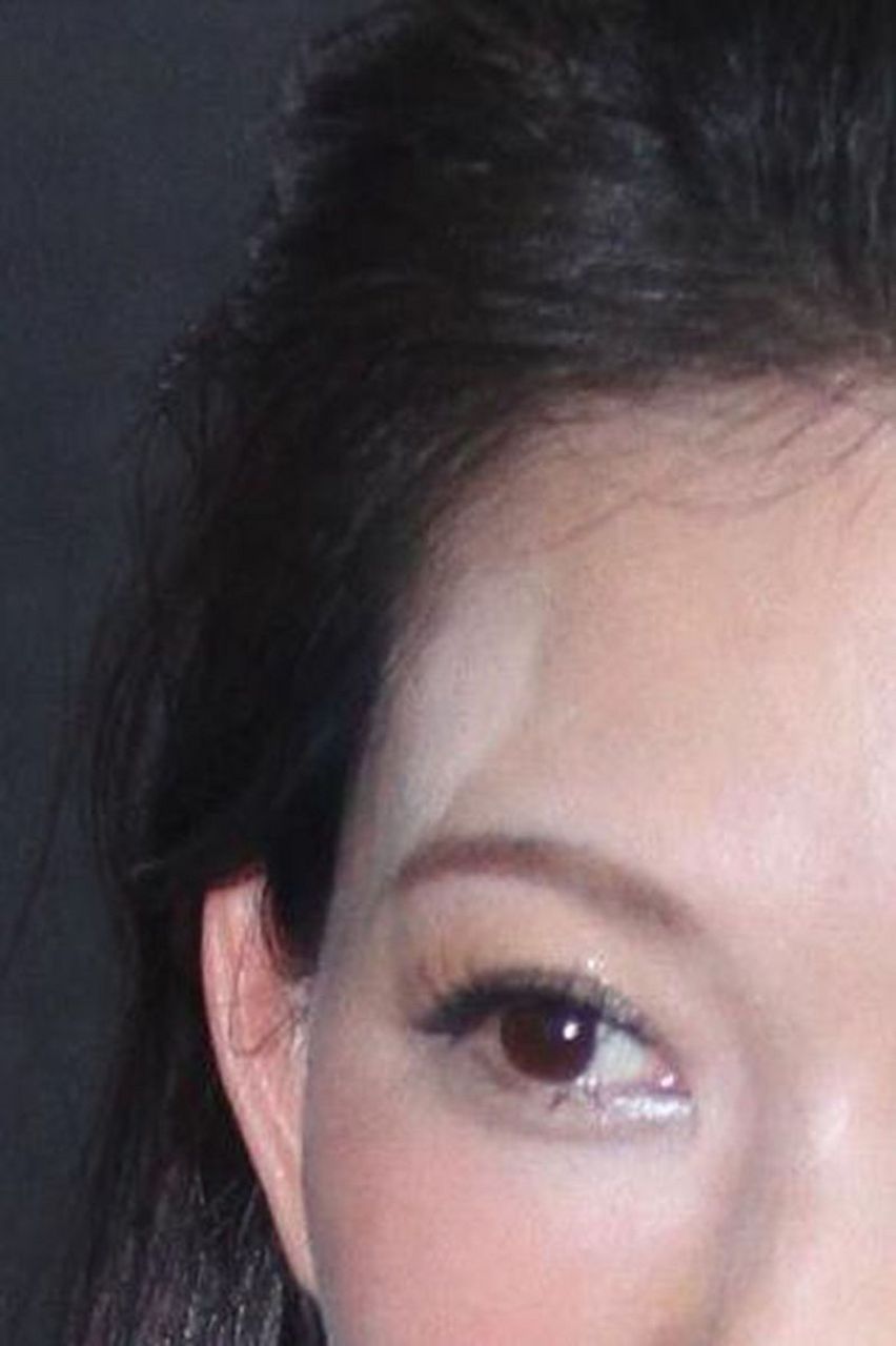 上眼皮浮肿下垂  随着年龄的增长,面部衰老常会显现为上眼皮的浮肿和