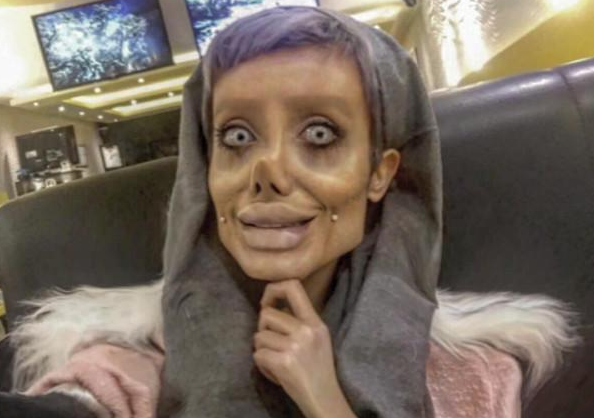 女子长相清纯,却不顾反对执意整容,不料越整越遭,变成僵尸模样