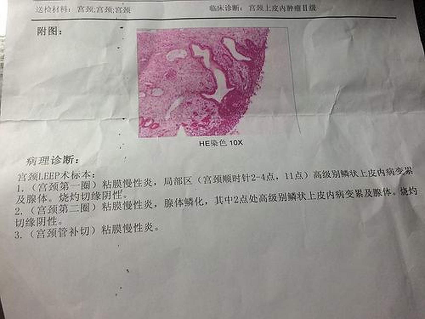 科普知识竞赛#宫颈活检就是子宫颈的活体组织检查,亦即从宫颈上取一