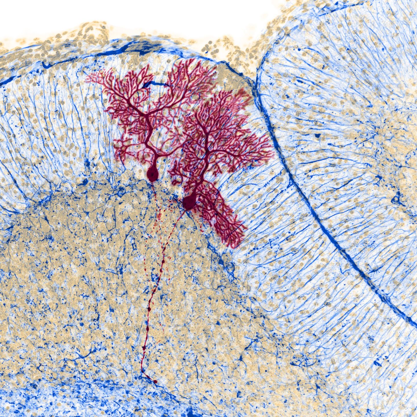 神经细胞 蒲公英的花粉,看起来像外星人的结构.