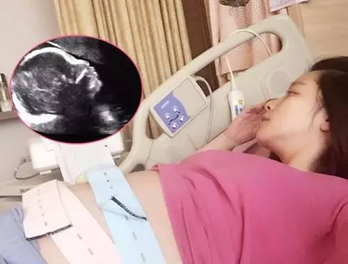 卧床保胎就一定是正确的吗?怎样情况才需卧床保胎?