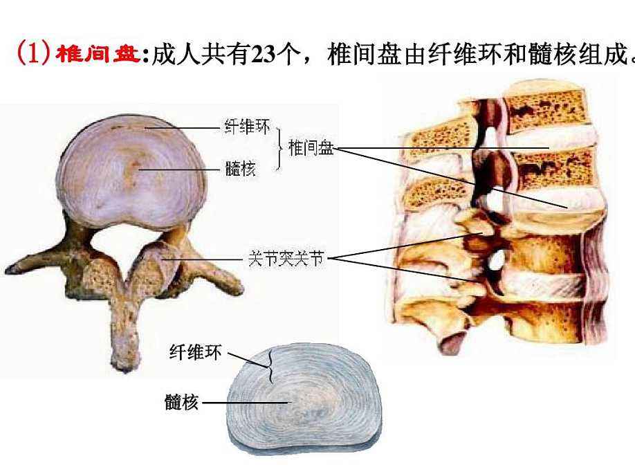 椎间盘突出最适合的姿势是什么?日常保养需要注意哪些?