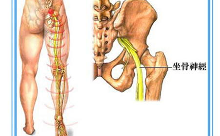 坐骨神经真人位置图图片
