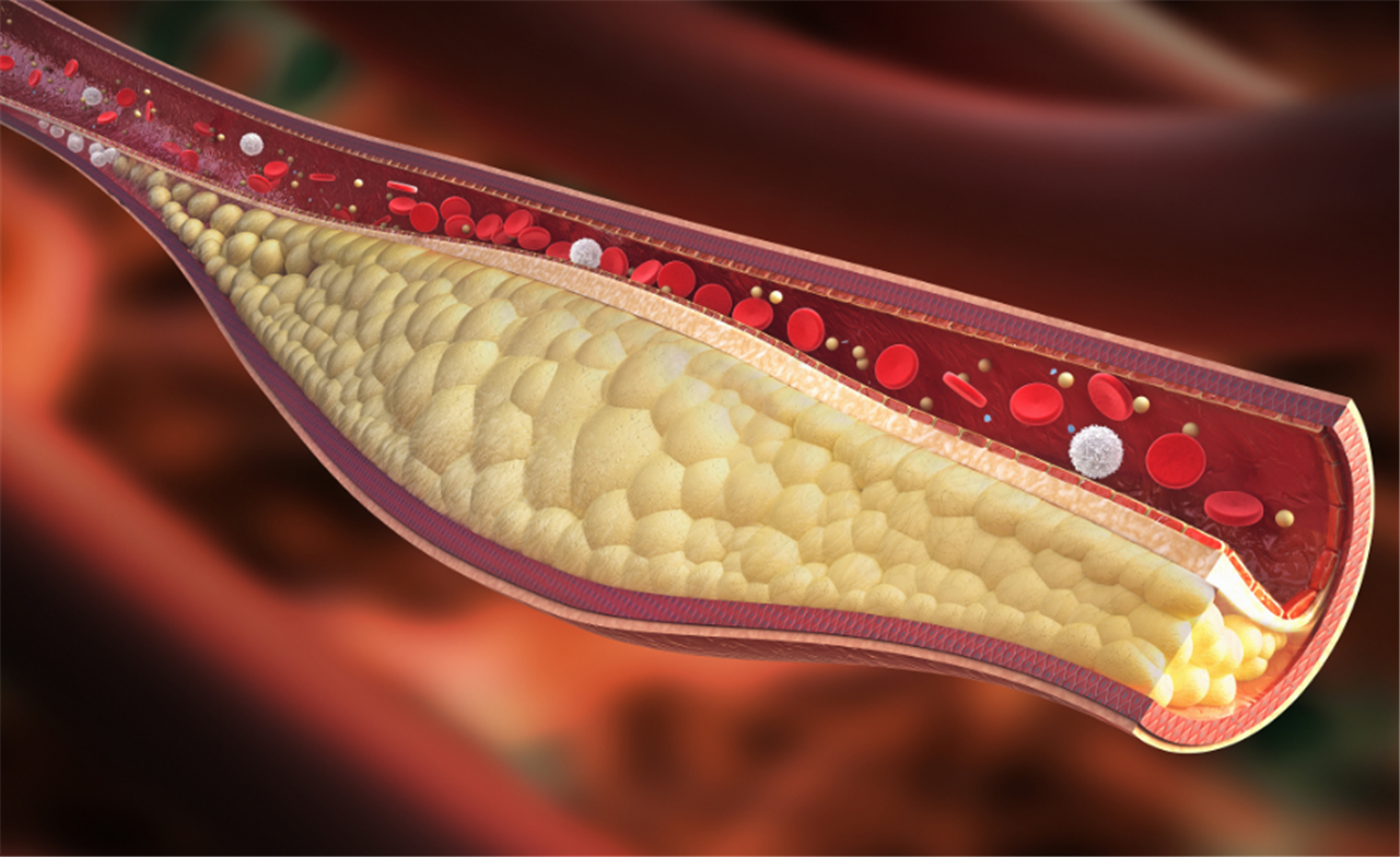 血液垃圾"天敌"找到了,经常吃一点,血管不堵不硬,赶走血栓!