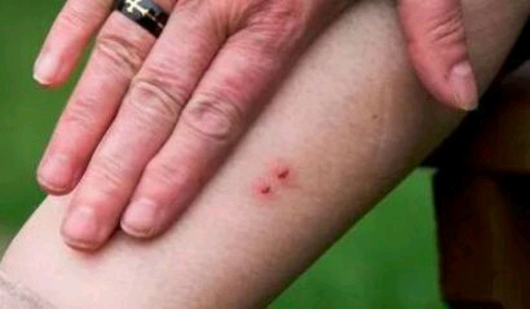 俗话说得好,打蛇打七寸,要是蛇没有七寸长怎么办?