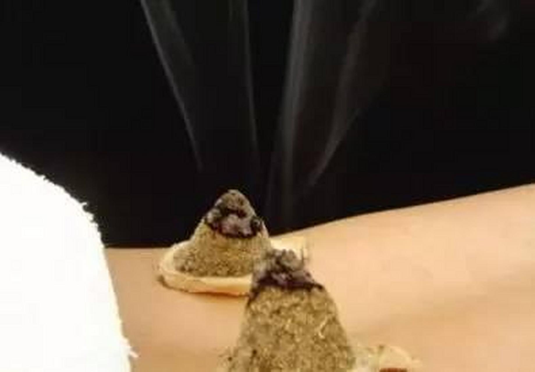 科普知识竞赛#直接灸是艾炷灸的一种,又称明灸,着肤灸.