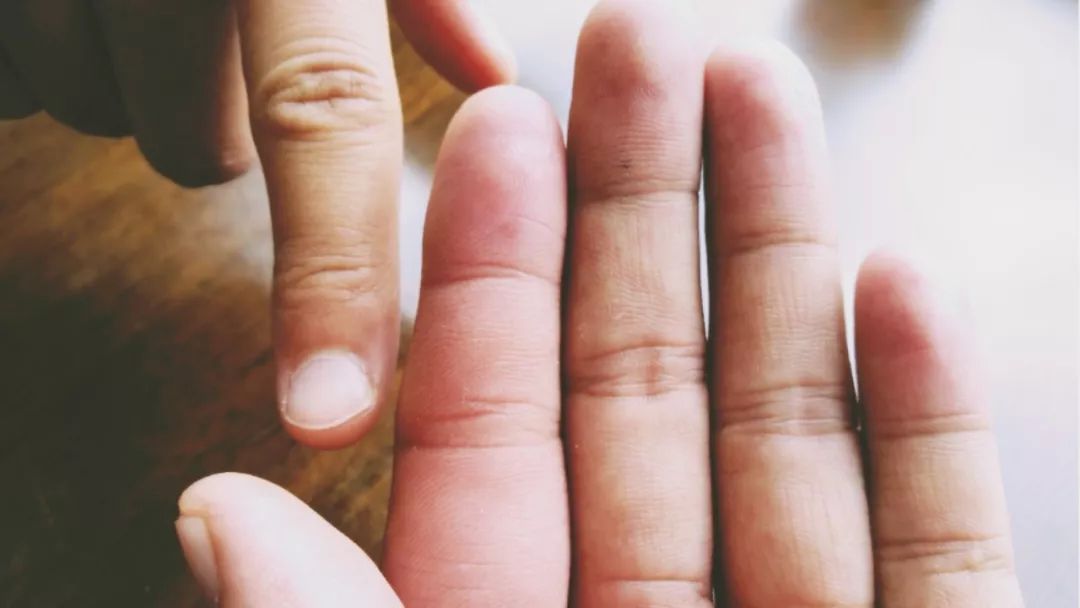 被蜜蜂蛰,被吊树上装小鸟,我不要脸地两刷了北海道一个冻湖