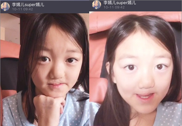 李嫣手术后上镜后遗症明显,被吐槽像老太太,李亚鹏四字霸气回应