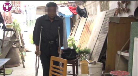 5年前意外捡到"铱-192"放射源带回家,3年花掉了300万治疗费