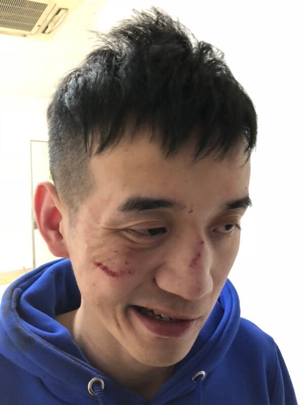 土木三班陈同学的《离人》火了,可贝拉拉被殴打,蛋蛋发微博澄清