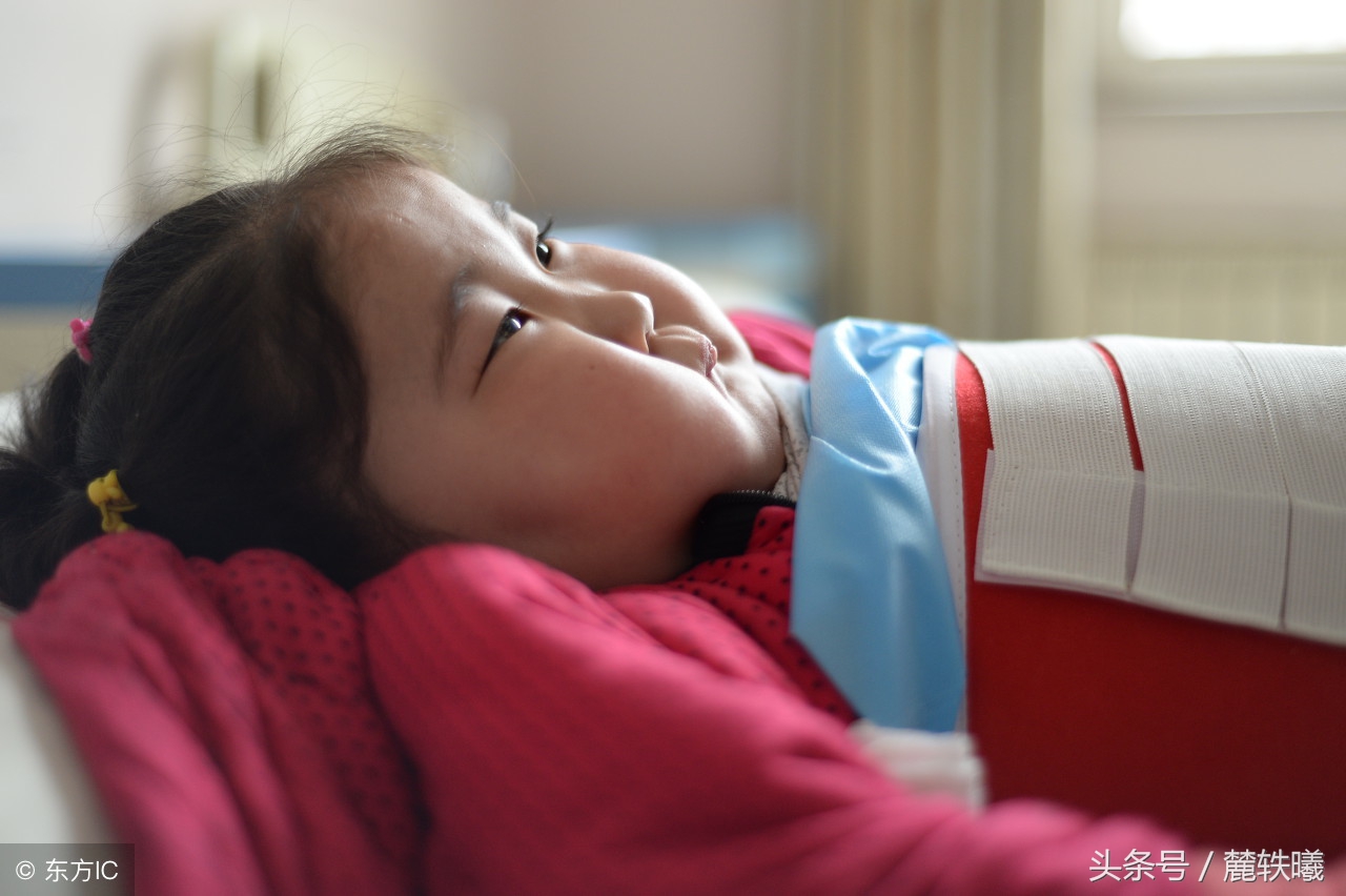 为了治病,小海清不得不服用了激素类药物,短短3个