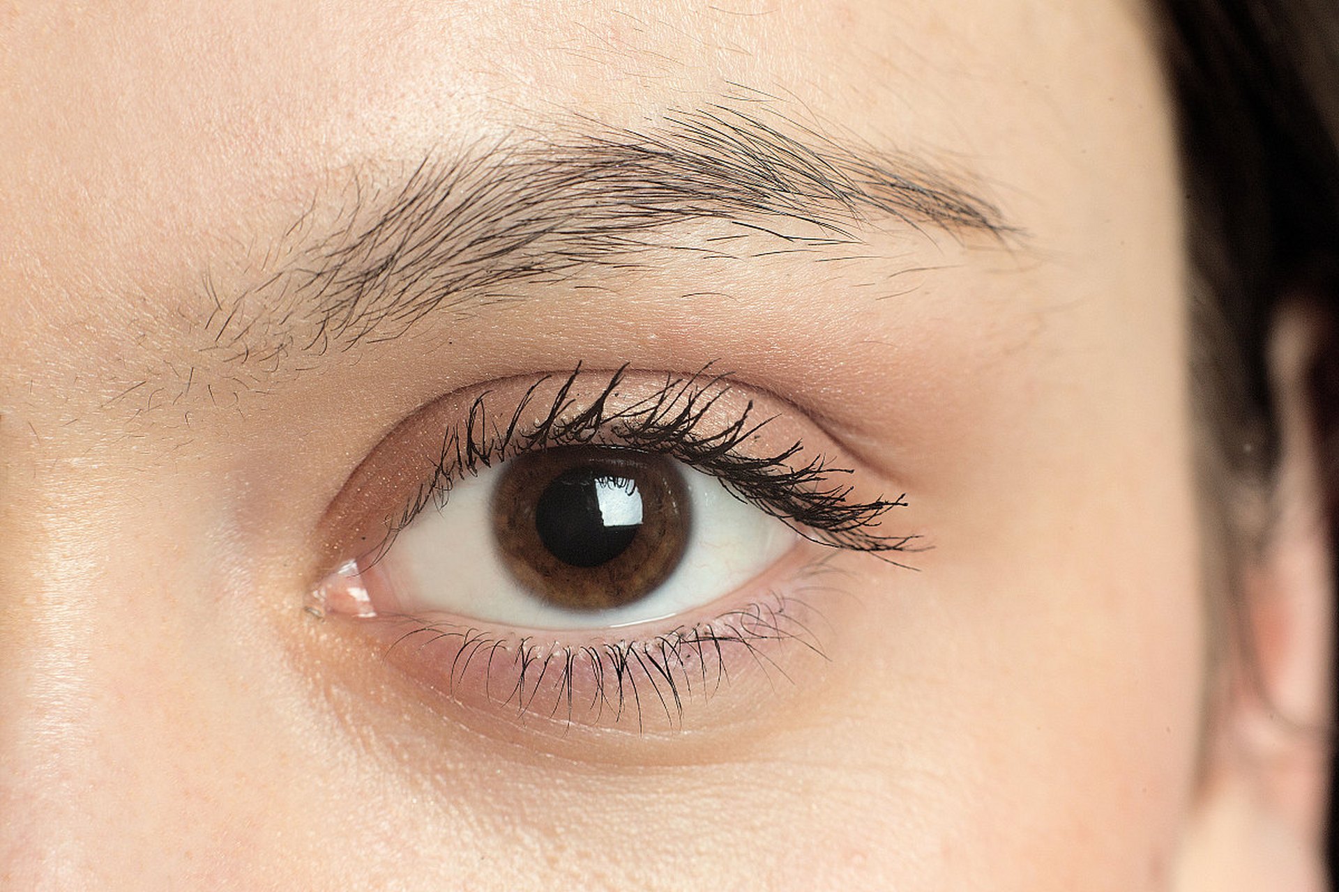 外眼角开了会回缩吗 #医美科普挑战赛#   开外眼角手术是一种常见的