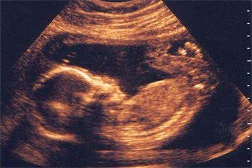 孕26周胎儿图片图片