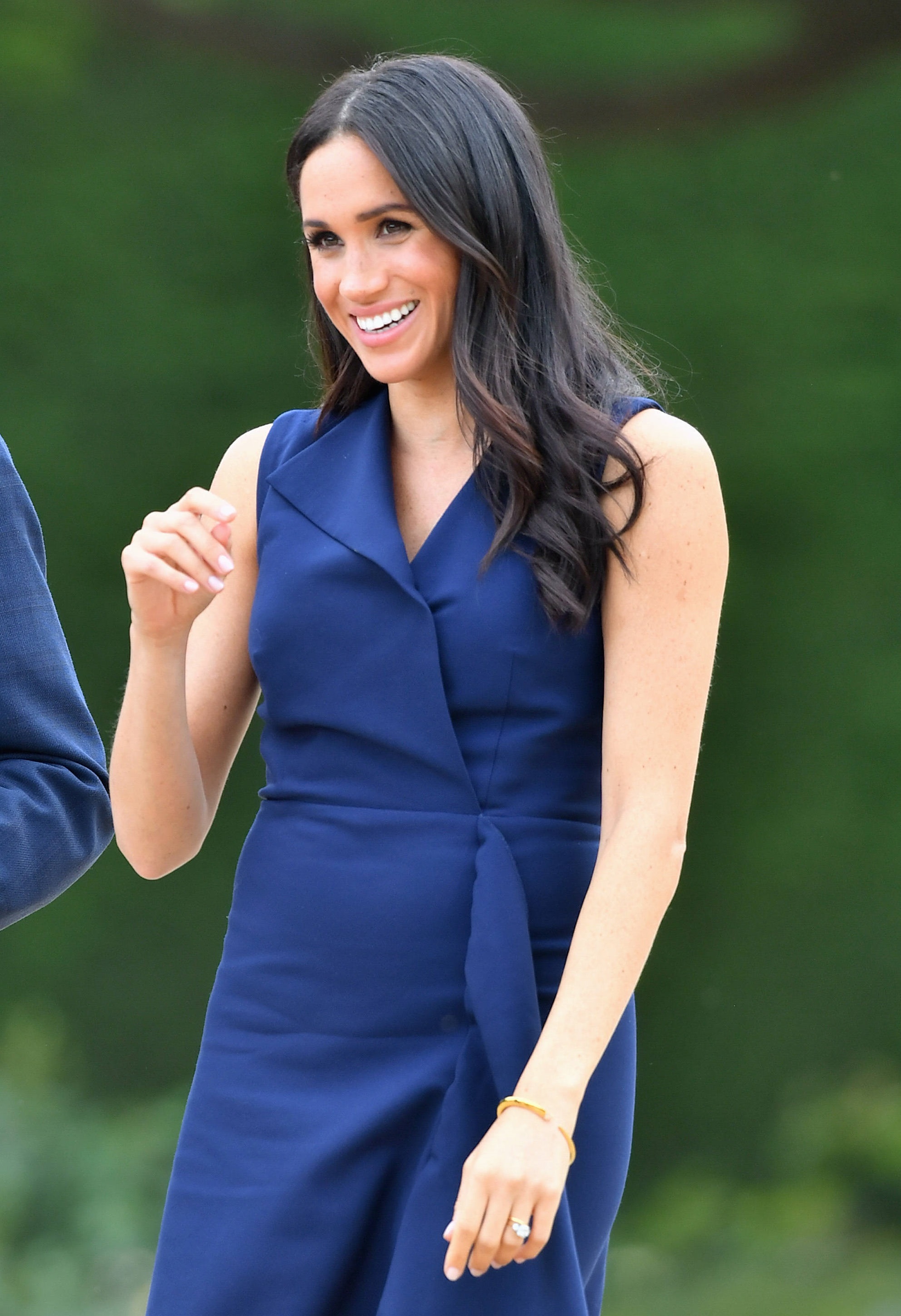 梅根澳洲行最佳着装,穿蓝色开叉裙变身"腿精",小腿竟没手臂粗