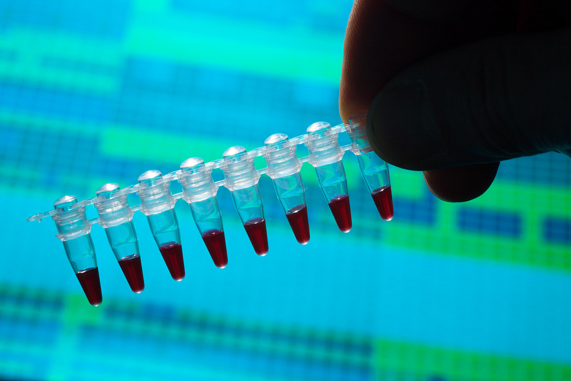 elisa实验操作技巧如下:  1.加血清样本及反应试剂.