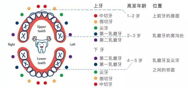 孩子乳牙坏了,家长如果不重视,会影响娃将来的颜值和语言发展