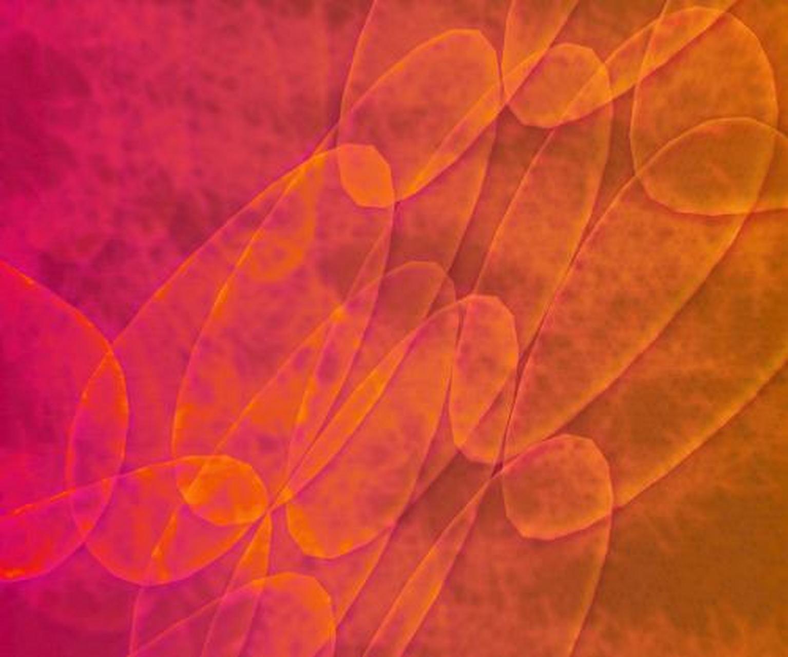 正常人血涂片中裂片细胞少于2%,弥散性血管内凝血,微血管病性溶血性