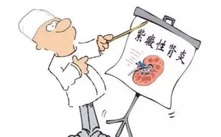 过敏性紫癜转肾炎严重吗