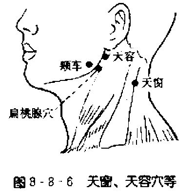 咽喉腫痛,按天窗,天窗穴:疏散內熱