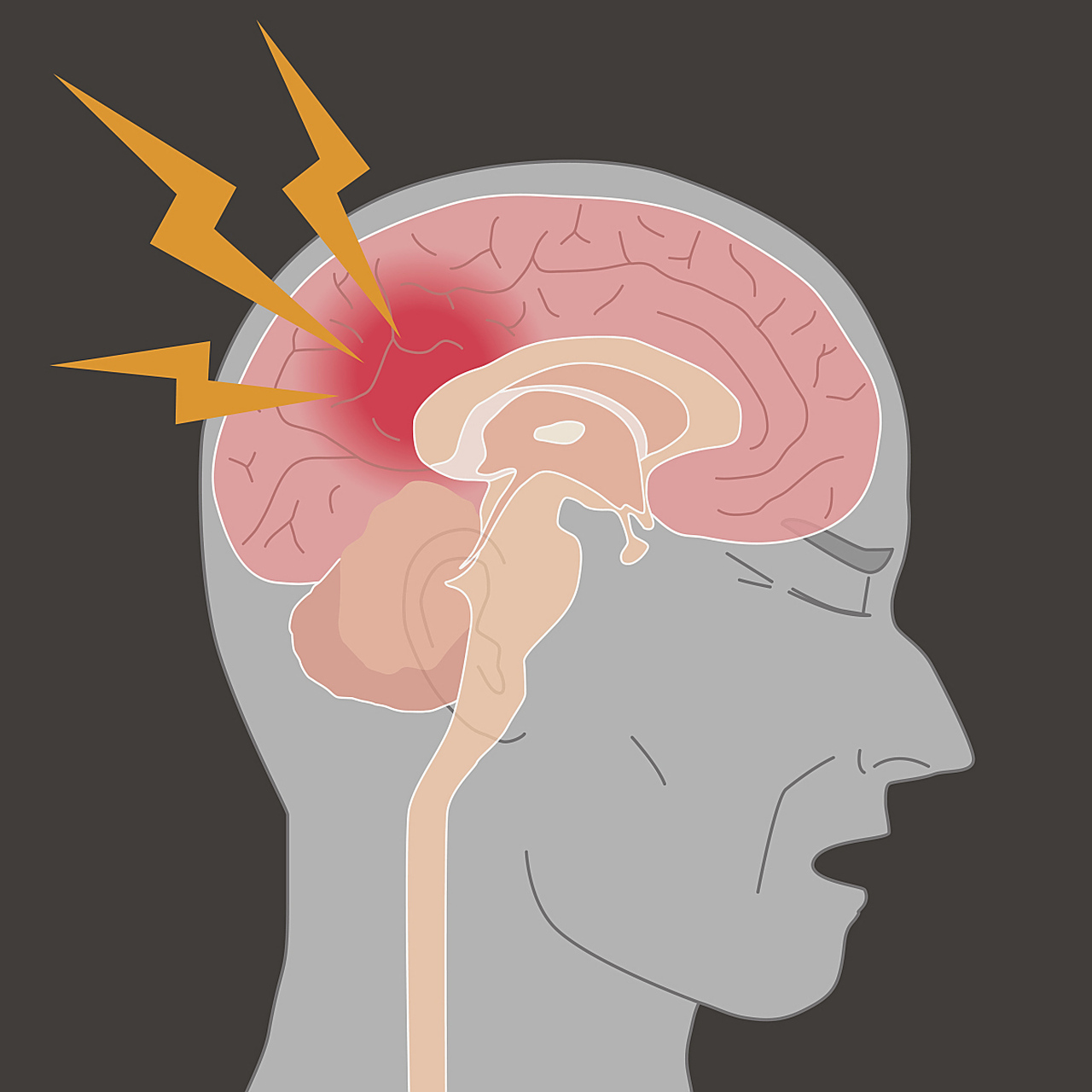 我和丈夫大吵了一架后,他开始打人,我被打到脑震荡  那一天,我们因为